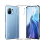 Чeхол-накладка BeCover для Xiaomi Mi 11 Lite/Mi 11 Lite 5G /11 Lite 5G NE Transparancy (706075)